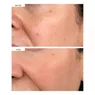 dark-spot-correcting-serum (5).png